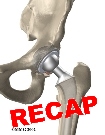 hkrecap